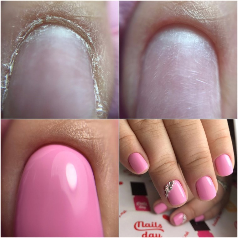 Покрытие под кутикулу