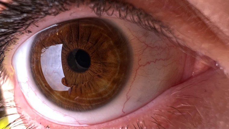 Человеческий глаз вблизи