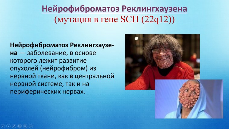 Презентация редкие заболевания
