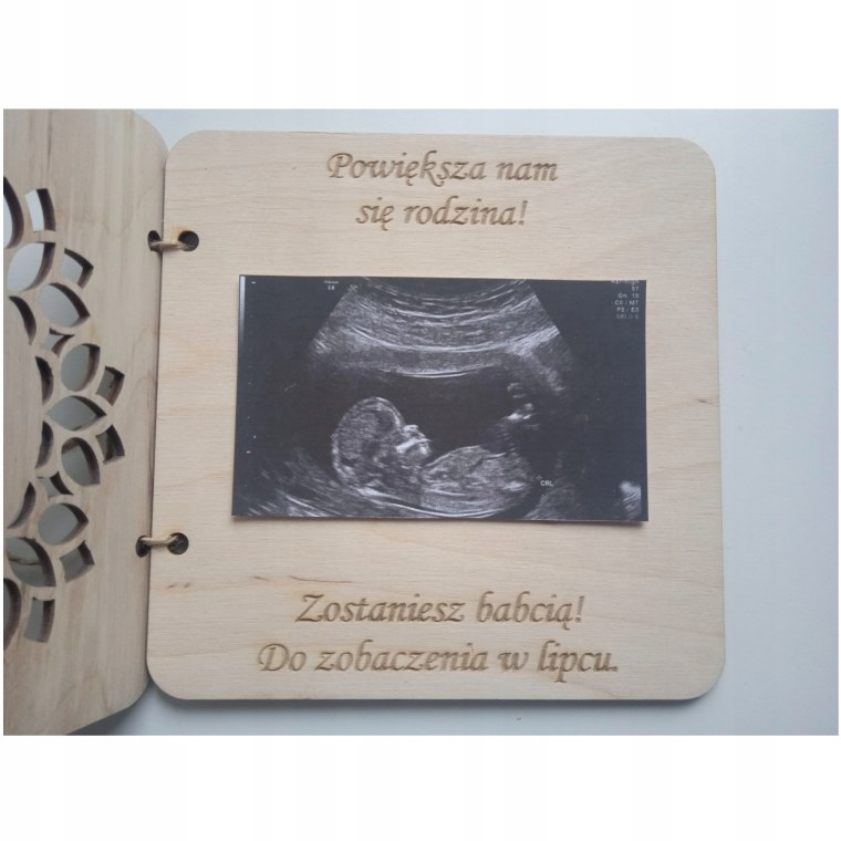 Вы скоро станете бабушкой и дедушкой открытки