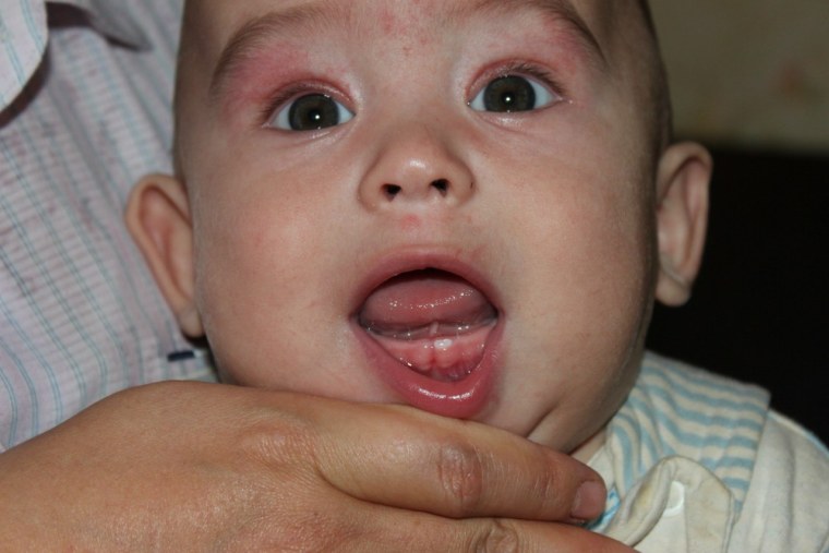 Открытки с первым зубиком ребенка