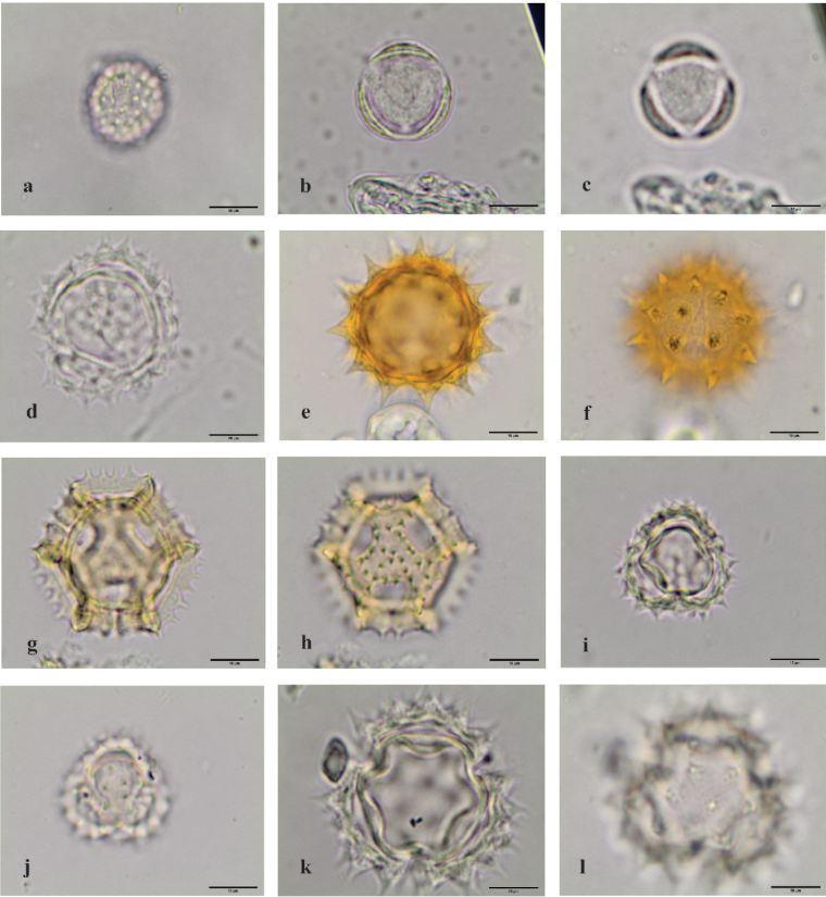 Пыльца микроскопия атлас