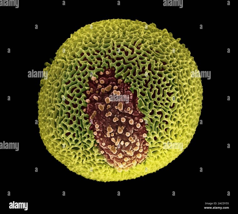 Пыльца амброзии под микроскопом