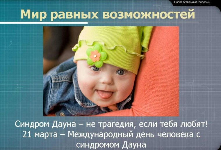 Всемирный день детей с синдромом Дауна