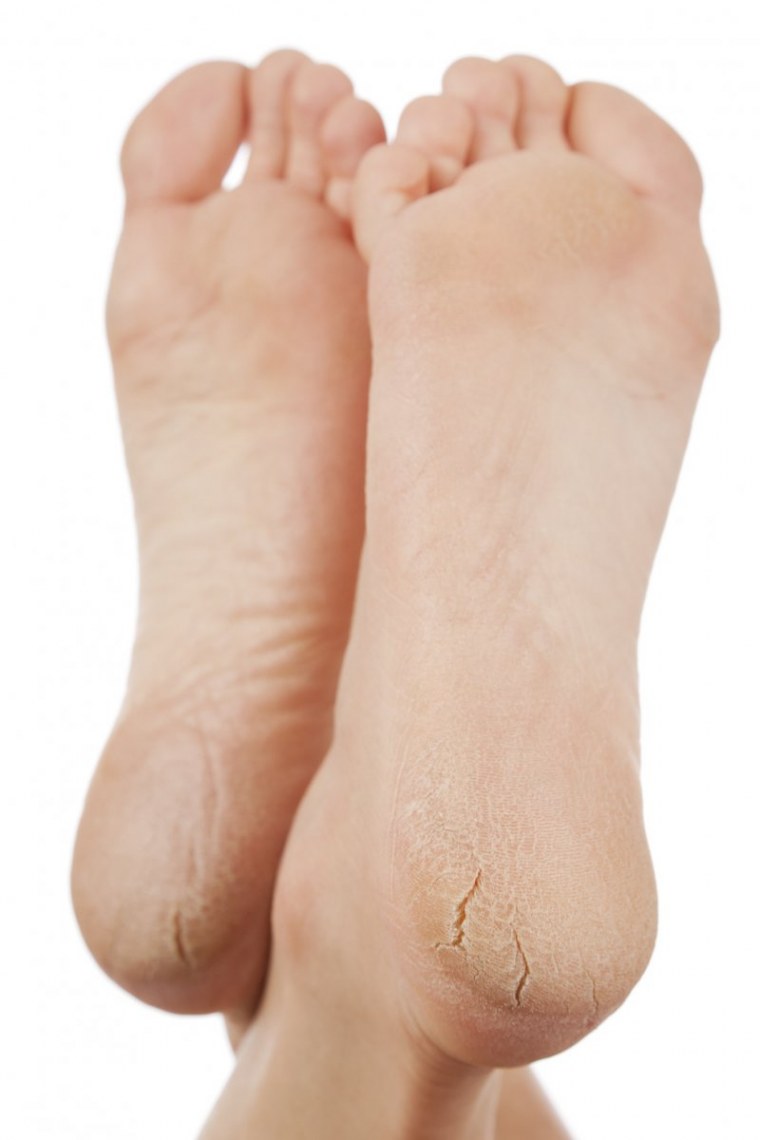 Стопы девушек