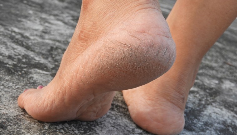 Женские стопы