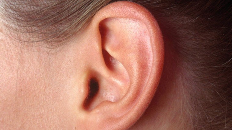 Лопоухие дети