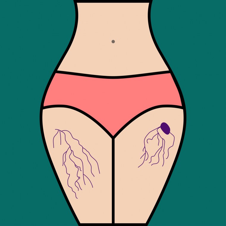 Пляжные зарисовки