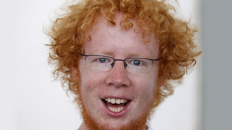 Лысая голова и челка мужская