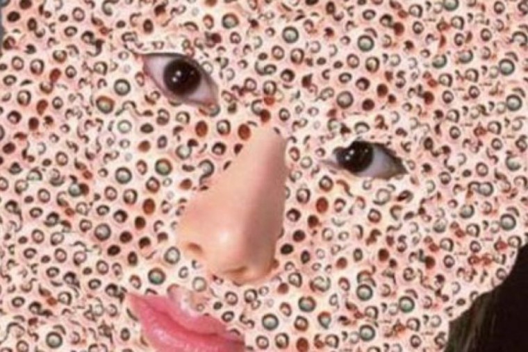 Джинсы с дырками на бедрах