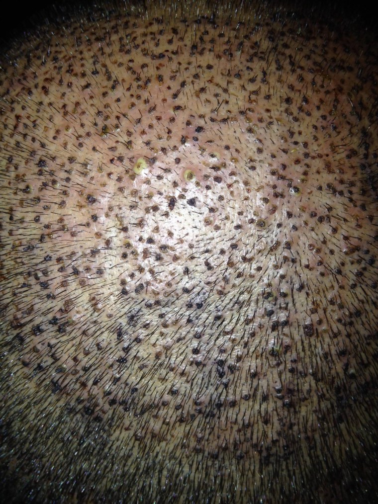 Много маленьких дырочек